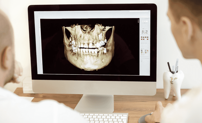 dentists in prahran looking at image taken with CBCT technology