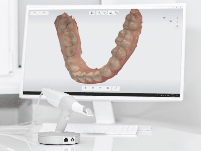 image on a computer screen from digital impressions taken at dentist prahran