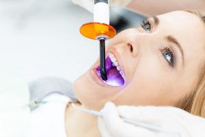 Female patient getting teeth whitened